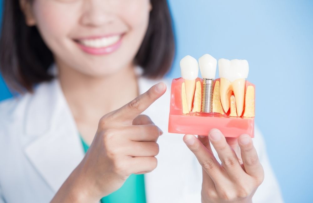 female doctor showing dental implants dummy