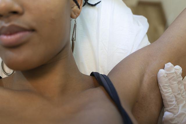 A model getting Laser hair treatment done.