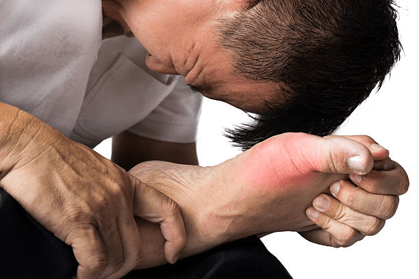 Gout Singapore: First Signs to Look For