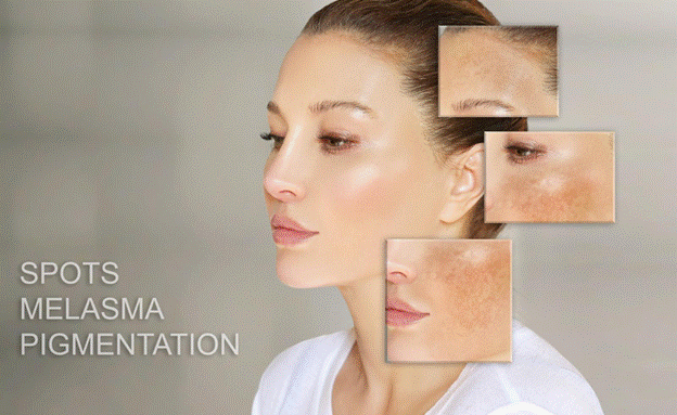 skincare habits