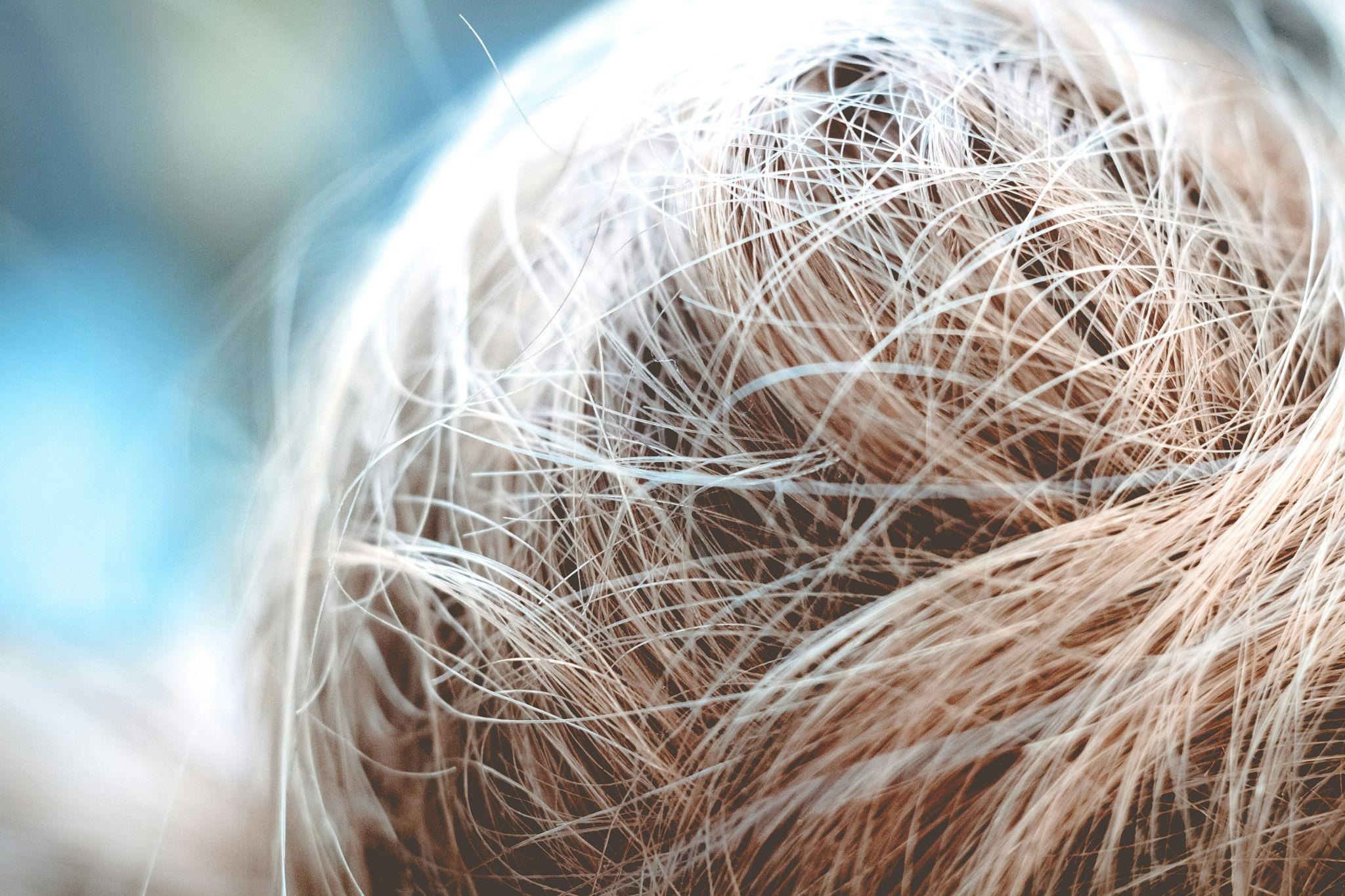Hair Thinning